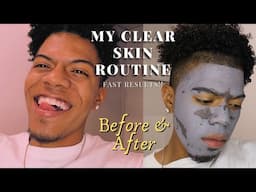 MY FACE/SKIN CARE ROUTINE!👀😍🔥 *24HOUR RESULTS*