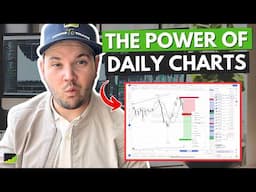 Why I Only Trade Daily Charts