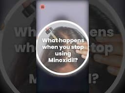 What happens when you stop applying Minoxidil?