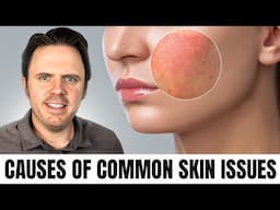 Causes of Common Skin Issues