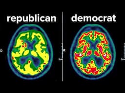 I Scanned A Democrat & Republican's Brains