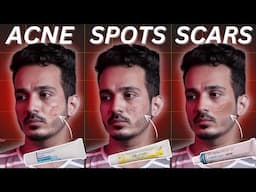 Apni Skin Problem Ke Liye Sahi Cream Kaise Chune? Ultimate Guide!