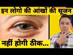 आंखों की सूजन नेचुरली कैसे ठीक करें || How to get rid of Puffy eyes naturally