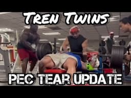 Tren Twins: Mickey’s Torn Pec Good News?