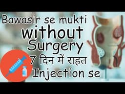 Sclerotherapy injection for piles | bawasir ka ilaj | piles treatment without operation