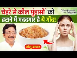 कील मुहांसो से ना हो परेशान, जानें यूनानी नुस्खा Home remedies for pimples