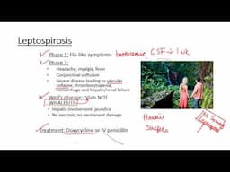 Leptospirosis