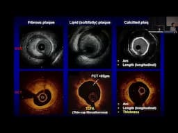 Samin K  Sharma, MD   Interventional Cardiology  Board Review 2024