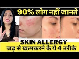 स्किन एलर्जी को खत्म  करने के चार घरेलु तरीके | Home Remedies To Eliminate Skin Allergies