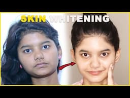 SKIN WHITENING Challenge | Skin Whitening Home Remedies | Anchal Shukla |