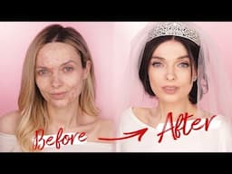 MEGHAN MARKLE WEDDING MAKEUP TUTORIAL! / ACNE COVERAGE // MyPaleSkin