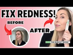 INSTANT RESULTS To Fix Redness Under $15! | The Budget Derm Reviews