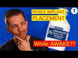 PENILE IMPLANT SURGERY...AWAKE?? [2024]