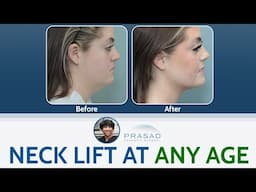 Neck Lift/Neck Tightening at Any Age