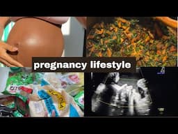 Pregnancy symptoms|My mother visiting Russia?| nose bleeding during pregnancy|baby scan .