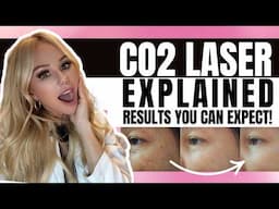 TRANSFORM Your Skin With CO2 Lasers - CO2 LASER TREATMENT WALKTHROUGH