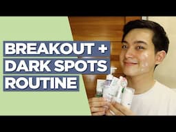 My Skincare Routine for ACNE BREAKOUT + DARK SPOTS! Affordable & Under P500! (Filipino) | Jan Angelo