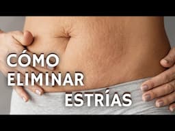 Cómo Eliminar las ESTRÍAS del ABDOMEN💪Resultados Sorprendentes 🌟👀