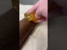 SUGARING | SUGAR WAX #waxing #hairremoval #sugarwaxing #sugarwax