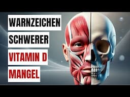 14 ANZEICHEN FÜR EINEN VITAMIN D MANGEL