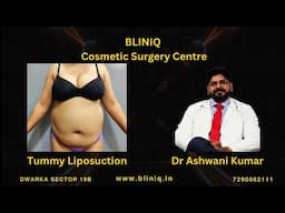 Tummy Liposuction Surgery LIVE!!!