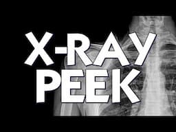 Magic Review - X-Ray Peek by Michel