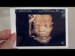 PREGNANCY VLOG: Nursery Update and 3D/4D Ultrasound!