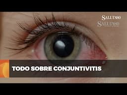 ✅ Todo sobre la conjuntivitis | Salud180 🌿