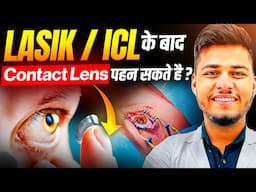 Can we Use contact lens after Lasik Or ICL surgery.