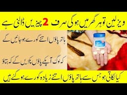 Mix 2 Things In Vaseline To Get Hand & Feet Whitening Very Fast | Hand Feet Whitening Winter Formula