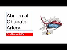 Abnormal (aberrant) obturator artery (corona mortis)