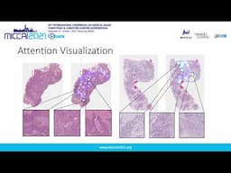 Pay Attention with Focus: A Novel Learning Scheme for Classification of Whole Slide Images