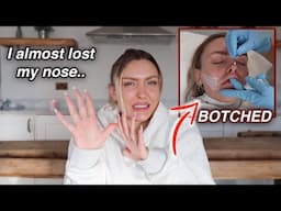 How I almost Lost my Nose from Cosmetic Surgery.. (A Horror Story)