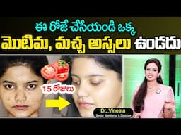 Dr Vineela - ఇవి తింటే ముఖం మిల మిల మెరిసిపోతుంది || Skin Brightening || SumanTV Health care