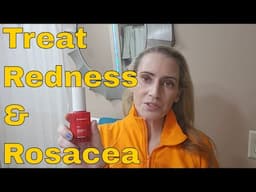 Rosacea - Do You Have Rosacea?  How to Treat Rosacea & Best Skincare Products for Rosacea & Redness