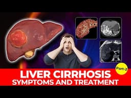 Fatty Liver Symptoms-2 | Early Signs of Fatty Liver Disease | Non Alcoholic Fatty Liver Disease