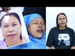 Bi-Jaw Surgery and Face Makeover | Manipur Woman’s Transformation