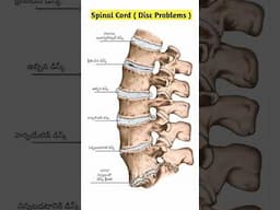 వెన్నుముక ( డిస్క్ ఇబ్బంది) |  Disc Problems #shorts #ytshorts #saanvidental #trendingshorts