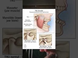 Looksmaxxing is destroying health