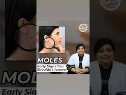 STOP Ignoring These MOLE Symptoms! #moles #shorts #drniveditadadu #youtube