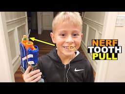 TOOTH PULLED OUT WITH NERF DART! 🦷