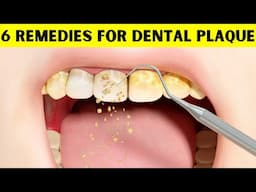 6 Natural Remedies For Dental Plaque - How To Get Rid Of Dental Plaque At Home Quickly