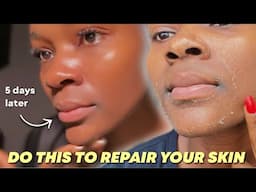 How to repair and protect your skin from actives | Skin recovery routine #skinrevival