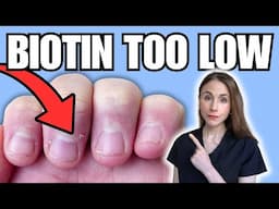 8 Biotin Deficiency Warning Signs NOT TO MISS | Hair, Skin, & Nails