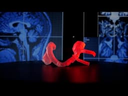 Aneurysm 3D print