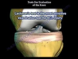 Tests For  Examination  Of The Knee   Everything You Need To Know   Dr  Nabil Ebraheim