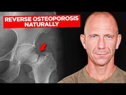 How to Strengthen your Bones and Reverse Osteoporosis Naturally [Patient Case studies]