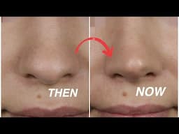 Effective Massage to SLIM YOUR NOSE, RESHAPE IT and SHARPEN IT | LETS MAKE OUR NOSE SMALLER