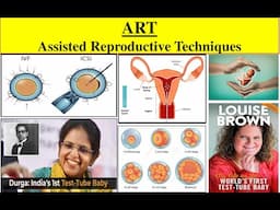 ART | Assisted Reproductive Technology | In Vitro Fertilization | ZIFT | GIFT | IUI | IUT | ICSI