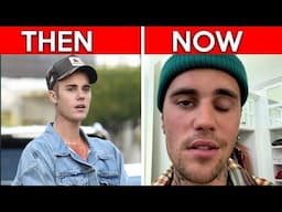 The Truth About JUSTIN BIEBERS FACE!